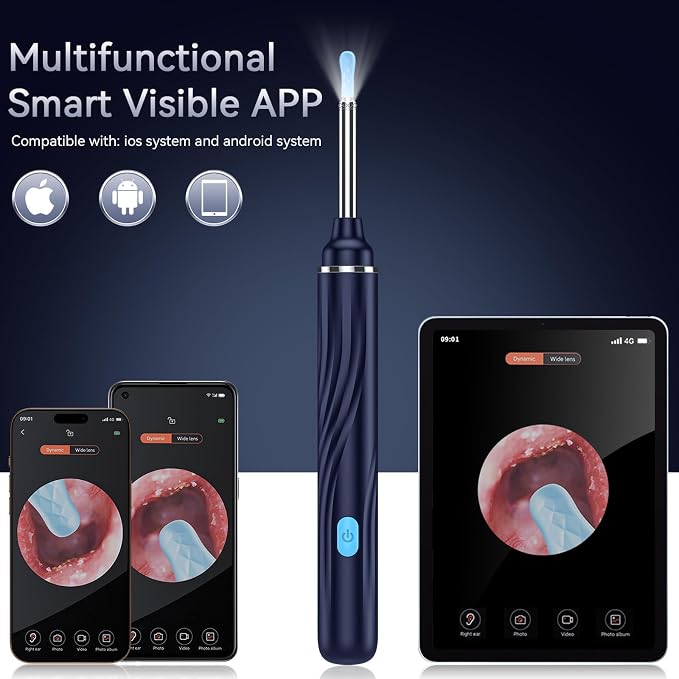 Ear Wax Removal Tool Camera, Ear Cleaner with Camera, 1080P HD Ear Camera and 6 LED Light, Ear Wax Removal Kit with 6 Ear Pick, 6 Pcs Ear Set, Ear Camera Wax Removal for iOS & Android, Blue