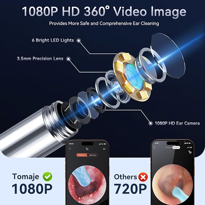 Ear Wax Removal Tool Camera, Ear Cleaner with Camera, Ear Wax Removal Kit, 1080P HD Ear Camera, Earwax Removal Kit with Camera and 6 LED Light, 6 Ear Pick & Ear Set for iOS & Android, Black
