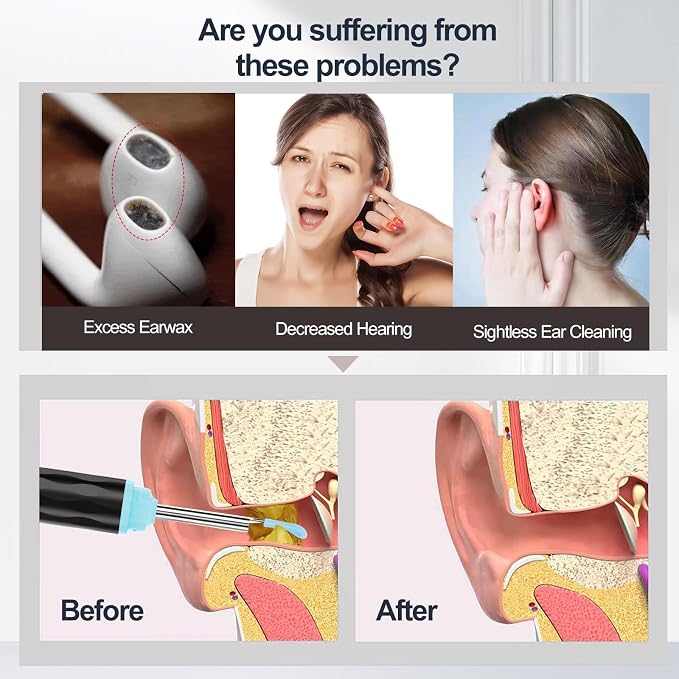 Ear Wax Removal, Ear Wax Removal Tool Camera Built-in 1296P, Easy and Safe Ear Cleaning, Earwax Removal kit with 9 Ear Set and 8 Traditional Tools, Ear Cleaning Kit for iPhone,iPad,Android (Black)