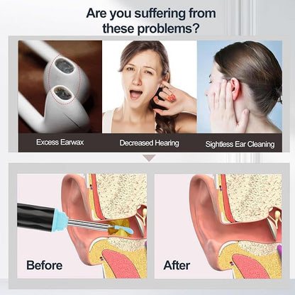 Ear Wax Removal, Ear Wax Removal Tool Camera Built-in 1296P, Easy and Safe Ear Cleaning, Earwax Removal kit with 9 Ear Set and 8 Traditional Tools, Ear Cleaning Kit for iPhone,iPad,Android (Black)