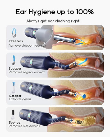 Earsight Plus I35R Ear Wax Removal Tool with Camera | Smart Visual Ear Cleaner with Gentle Tweezers & 12 Tips, HD Otoscope for Adults & Kids