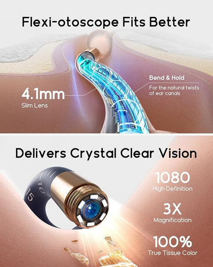 Earsight Plus I35R Ear Wax Removal Tool with Camera | Smart Visual Ear Cleaner with Gentle Tweezers & 12 Tips, HD Otoscope for Adults & Kids